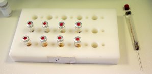 4,2 Prozent der Hochleistungssportler in den Niederlanden haben Doping zugegeben Niederlande