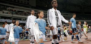Kingsley Coman soll am Wochenende zum Medizincheck in München Kingsley Coman