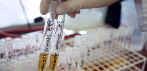 Die NADAs fordern eine Ämtertrennung im Anti-Doping-Kampf NADA