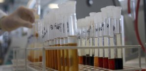 Droht das nächste Doping-Beben? Doping