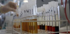Auch in der BRD soll es flächendeckendes Doping gegeben haben Doping