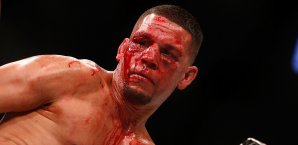 Nate Diaz