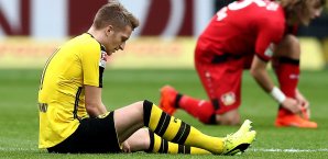 Marco Reus wird das Spiel in München wohl noch nicht bestreiten können Marco Reus